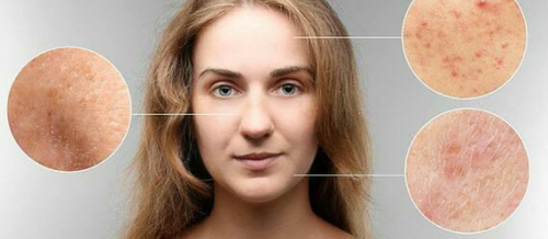 Dermatologiya, Dəri xəstəlikləri, Dermatoloji, Aknenin müalicəsi, Dermatoveneroloq Dermatologiya, Dəri xəstəlikləri, Dermatoloji, Aknenin müalicəsi, Dermatoveneroloq