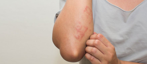 Dermatologiya, Dəri xəstəlikləri, Dermatoloji xəstəliklər, Dermatoloqun vəzifələri Dermatologiya, Dəri xəstəlikləri, Dermatoloji xəstəliklər, Dermatoloqun vəzifələri