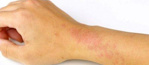 Dermatologiya, Dərinin allergik xəstəlikləri, Dermatoloji xəstəliklə, Dermokosmetik prosedurlar Dermatologiya, Dərinin allergik xəstəlikləri, Dermatoloji xəstəliklə, Dermokosmetik prosedurlar