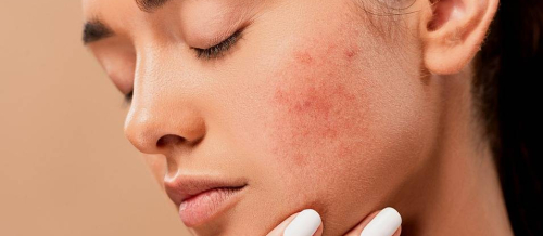 Dermatovenerologiya, Dəri xəstəliklərinin müalicəsi, Dəri xəstəliklərini yaradan səbəblər, Dəri xəstəliklərinin əlamətləri Dermatovenerologiya, Dəri xəstəliklərinin müalicəsi, Dəri xəstəliklərini yaradan səbəblər, Dəri xəstəliklərinin əlamətləri