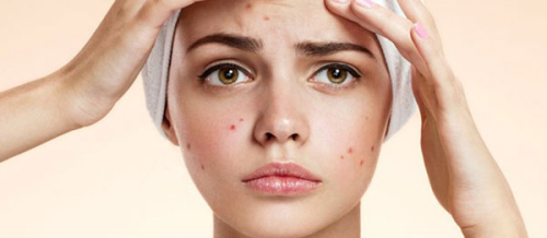 Dermatokosmetik prosedurlar, Dermatoloq, mezoterapiya, Üzdə səpgilər, Akne Dermatokosmetik prosedurlar, Dermatoloq, mezoterapiya, Üzdə səpgilər, Akne