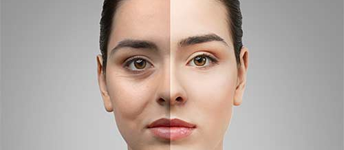 Dermatologiya, Dəri xəstəliklərinin səbəbləri, Akne Vulgaris, Aknenin müalicəsi, dermatoloji xəstəliklər Dermatologiya, Dəri xəstəliklərinin səbəbləri, Akne Vulgaris, Aknenin müalicəsi, dermatoloji xəstəliklər