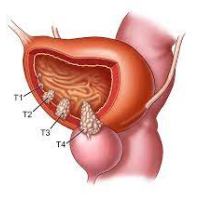 Cinsi xəstəliklərin əlamətləri, cinsi infeksiyalar, Cinsi xəstəliklərin müalicəsi, Cinsi zəiflik
