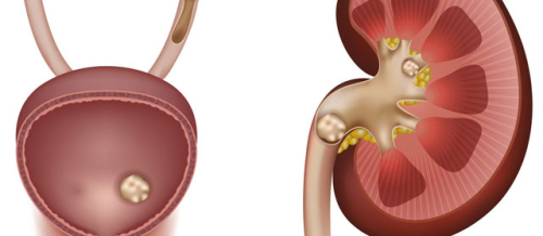 Andrologiya, Androloji problemlər, Urologiya və Andrologiya, Cinsi zəifliyin səbəbləri