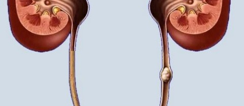 Andrologiya, Androloji problemlər, Urologiya və Andrologiya, Cinsi zəifliyin səbəbləri