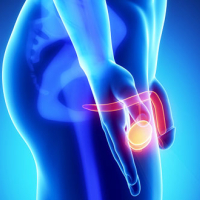 Andrologiya, Cinsi zəifliyin diaqnozu, cinsi zəifliyin müalicəsi, sonsuzluğun səbəbi