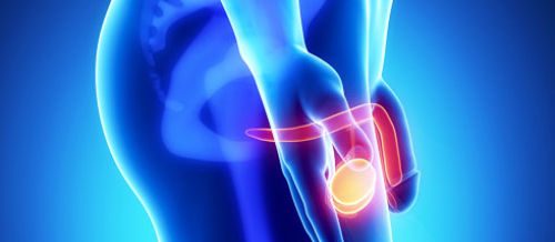 Andrologiya, Cinsi zəifliyin diaqnozu, cinsi zəifliyin müalicəsi, sonsuzluğun səbəbi