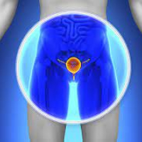 Andrologiya, Cinsi zəifliyin diaqnozu, cinsi zəifliyin müalicəsi, sonsuzluğun səbəbi