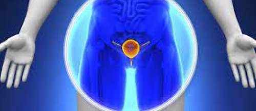 Andrologiya, Cinsi zəifliyin diaqnozu, cinsi zəifliyin müalicəsi, sonsuzluğun səbəbi