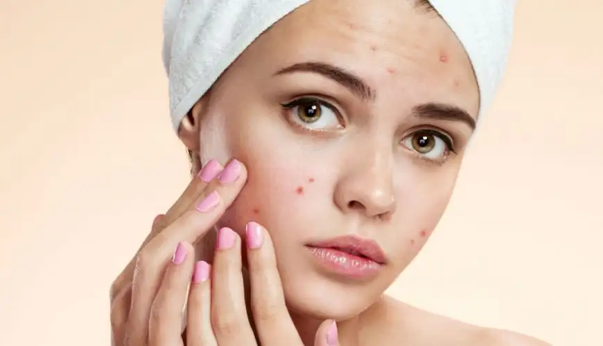Dermatoloq, Həkim Dermatoloq, Dermatoloqlar, Dəri xəstəlikləri, Kosmetik problemlər, Dermatologiya
