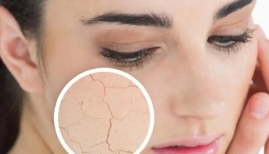 Dermatologiya nədir, Dermatoloji Mütəxəssislər və Həkimlər, Dermatoloji şərtlər, Dermatoloji Müalicə