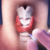 Endokrin xəstəliklər, Endokrin sistemi, Endokrinologiya, Endokrinologiya nədir, Endokrin vəzlər, endokrin xəstəliklər