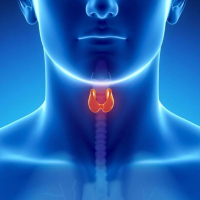 Hipotireoz nədir, Hipotireozun əsas əlamətləri, Düyünlü ur, Qalxanabənzər vəz, düyünlü törəmə, Diffuz toksiki ur