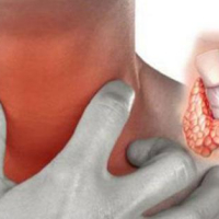 Endokrinologiya, Şəkərsiz diabet, endokrinoloji, Şəkərli Diabet, Endokrin sonsuzluq