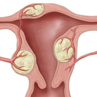 Ginekologiya şöbəsi hansı xəstəlikləri müalicə edir, Ginekologiya şöbəsi, Ginekoloji xərçəng Ginekologiya şöbəsi hansı xəstəlikləri müalicə edir, Ginekologiya şöbəsi, Ginekoloji xərçəng
