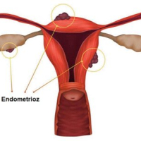 Ginekologiya, Ginekoloq, Mama Ginekoloq, Ginekologiya nədir, cinsi xəstəliklər Ginekologiya, Ginekoloq, Mama Ginekoloq, Ginekologiya nədir, cinsi xəstəliklər