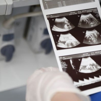 Mamalıq və Ginekologiya, Ginekologiya şöbəsi, Hamiləlik və Doğum, Hamiləlik öncəsi müayinə Mamalıq və Ginekologiya, Ginekologiya şöbəsi, Hamiləlik və Doğum, Hamiləlik öncəsi müayinə