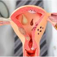 Ginekologiya nədir, ginekoloji xəstəliklər, ginekoloq, ginekoloji müayinə, ginekoloji müalicə Ginekologiya nədir, ginekoloji xəstəliklər, ginekoloq, ginekoloji müayinə, ginekoloji müalicə