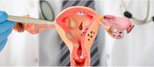 Ginekologiya nədir, ginekoloji xəstəliklər, ginekoloq, ginekoloji müayinə, ginekoloji müalicə