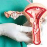 Qadın cinsi xəstəlikləri, ginekoloji xəstəliklər, mama ginekoloq, ginekoloji müayinə, ginekoloji müalicə, ginekoloji yoxlanış Qadın cinsi xəstəlikləri, ginekoloji xəstəliklər, mama ginekoloq, ginekoloji müayinə, ginekoloji müalicə, ginekoloji yoxlanış