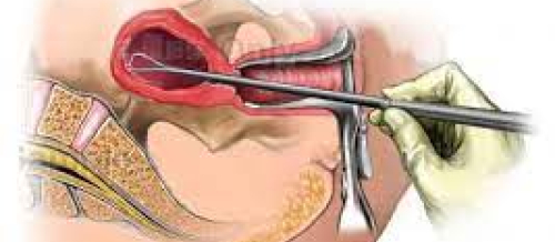 Qadın cinsi xəstəlikləri, ginekoloji xəstəliklər, mama ginekoloq, ginekoloji müayinə, ginekoloji müalicə, ginekoloji yoxlanış