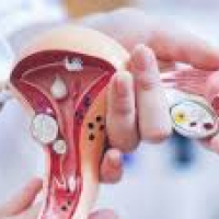 Ginekoloji müayinə, qadın xəstəlikləri, ginekoloq, ginekoloji müalicə Ginekoloji müayinə, qadın xəstəlikləri, ginekoloq, ginekoloji müalicə