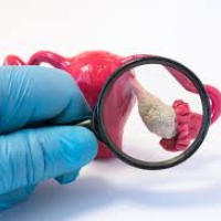 ginekoloji xəstəliklər, qadın xəstəlikləri, ginekoloji analizlər, ginekoloji suallar, ginekoloq ginekoloji xəstəliklər, qadın xəstəlikləri, ginekoloji analizlər, ginekoloji suallar, ginekoloq