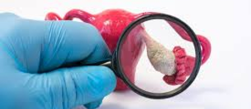 ginekoloji xəstəliklər, qadın xəstəlikləri, ginekoloji analizlər, ginekoloji suallar, ginekoloq