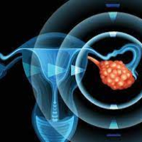 Hamilə qalmağın üsulları, menstruasiya, ginekoloji xəstəliklər, ginekoloji müalicə Hamilə qalmağın üsulları, menstruasiya, ginekoloji xəstəliklər, ginekoloji müalicə