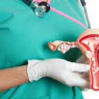 ginekoloji xəstəliklər, Cinsi yolla keçən xəstəliklər, qadın xəstəlikləri ginekoloji xəstəliklər, Cinsi yolla keçən xəstəliklər, qadın xəstəlikləri