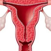 ginekoloji xəstəliklər, Cinsi yolla keçən xəstəliklər, qadın xəstəlikləri ginekoloji xəstəliklər, Cinsi yolla keçən xəstəliklər, qadın xəstəlikləri