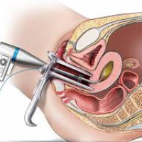 Ginekologiya, ginekoloji xəstəliklər, ginekoloji müayinə, ginekoloji müalicə, qadın xəstəlikləri Ginekologiya, ginekoloji xəstəliklər, ginekoloji müayinə, ginekoloji müalicə, qadın xəstəlikləri