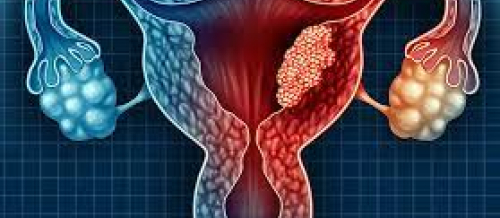 Menstruasiya pozulmaları, qanama və menstruasiya ağrıları, Anormal uşaqlıq qanaxması, Hipermenoreya