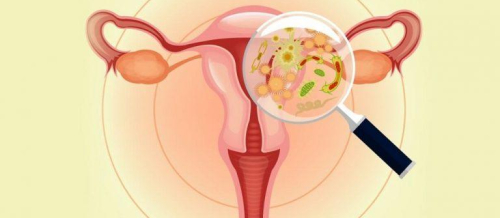 Uşaqlıq daxili spiral, Hormunlu spiralın faydaları, Hormonlu spiral, Hamiləlikdən qorunmaq