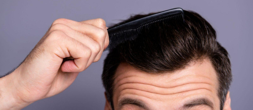 Saç tökülməsi, Saçların tökülməsi problemi, həkim-trixoloq, Müasir saç transplantasiyası, Saç köçürülməsi