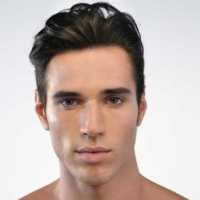 Saç köçürmələri, Saç tökülməsi problemi, saç transplantasiyası, Saçların nəqli, Saç Əkimi Qiymətləri Saç köçürmələri, Saç tökülməsi problemi, saç transplantasiyası, Saçların nəqli, Saç Əkimi Qiymətləri