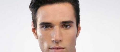 Saç köçürmələri, Saç tökülməsi problemi, saç transplantasiyası, Saçların nəqli, Saç Əkimi Qiymətləri