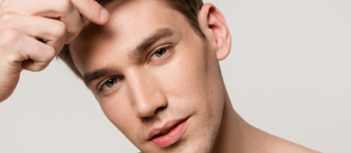 SAÇ TRANSPLANTASİYASI, SAÇ TRANSPLANTASİYASI NƏDİR, FUE transplantasiyası, Saç əkimi əməliyyatı