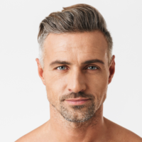 Kişi saç əkimi, Saç transplantasiyasına hazırlıq, kişi saç əkilməsi prosesi, Saç əkilməsinin nəticəsi Kişi saç əkimi, Saç transplantasiyasına hazırlıq, kişi saç əkilməsi prosesi, Saç əkilməsinin nəticəsi