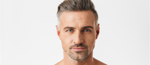 Kişi saç əkimi, Saç transplantasiyasına hazırlıq, kişi saç əkilməsi prosesi, Saç əkilməsinin nəticəsi