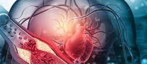 Ürək xəstəlikləri, kardioloji xəstəliklərin əlamətləri, kardioloji check up