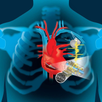 Aritmiyalar və ya ürəyin ritm pozuntusu, artan ürək döyüntüsü, Aritmiyaların tipləri, kadioloq Aritmiyalar və ya ürəyin ritm pozuntusu, artan ürək döyüntüsü, Aritmiyaların tipləri, kadioloq