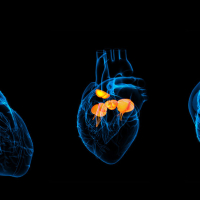 Piylənmənin səbəb olduğu ürək xəstəlikləri, EKQ, EXO-KQ, Ürək-damar sisteminin xəstəlikləri, Ürəyin işemik xəstəliyi Piylənmənin səbəb olduğu ürək xəstəlikləri, EKQ, EXO-KQ, Ürək-damar sisteminin xəstəlikləri, Ürəyin işemik xəstəliyi