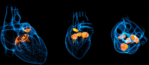 Piylənmənin səbəb olduğu ürək xəstəlikləri, EKQ, EXO-KQ, Ürək-damar sisteminin xəstəlikləri, Ürəyin işemik xəstəliyi Piylənmənin səbəb olduğu ürək xəstəlikləri, EKQ, EXO-KQ, Ürək-damar sisteminin xəstəlikləri, Ürəyin işemik xəstəliyi