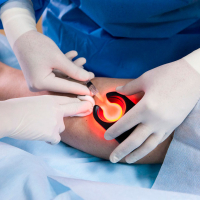 Ürək xəstəlikləri diaqnostikası və müalicəsi, ürək xəstəliyi, Ürək çatışmazlığı, kardiologiya Ürək xəstəlikləri diaqnostikası və müalicəsi, ürək xəstəliyi, Ürək çatışmazlığı, kardiologiya