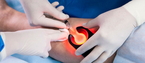 Ürək xəstəlikləri diaqnostikası və müalicəsi, ürək xəstəliyi, Ürək çatışmazlığı, kardiologiya Ürək xəstəlikləri diaqnostikası və müalicəsi, ürək xəstəliyi, Ürək çatışmazlığı, kardiologiya