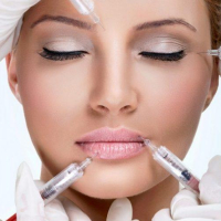 Botoks nədir, qırış müalicəsi, üzün formalaşdırılması, tərləmə müalicəsi, Migren müalicəsi
