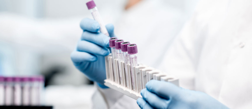 Qanın kliniki  analizi, QKA, Analizlər, Laborator analizlər, Qanın ümumi analizi qiyməti