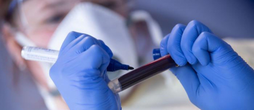 Ümumi qan analizi, Qanın klinik analizi, Hemoqlobin, Laborator müayinələr, Laboratoriya nəticələri