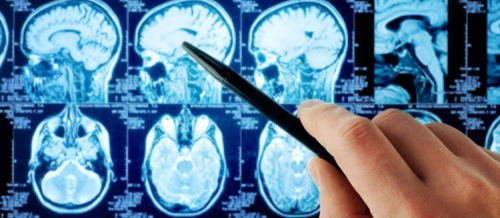 Nevrologiya, Nevroloji xəstəliklər, Baş ağrısı, demensiya, Yuxu pozğunluqları, əzələ xəstəlikləri, nevroloji müayinə Nevrologiya, Nevroloji xəstəliklər, Baş ağrısı, demensiya, Yuxu pozğunluqları, əzələ xəstəlikləri, nevroloji müayinə